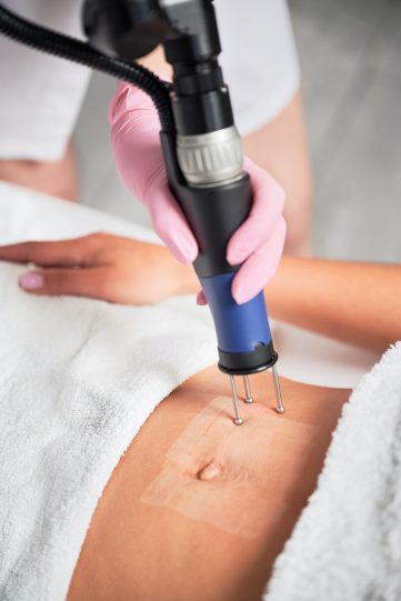 Young woman receiving abdominal laser treatment in clinic.